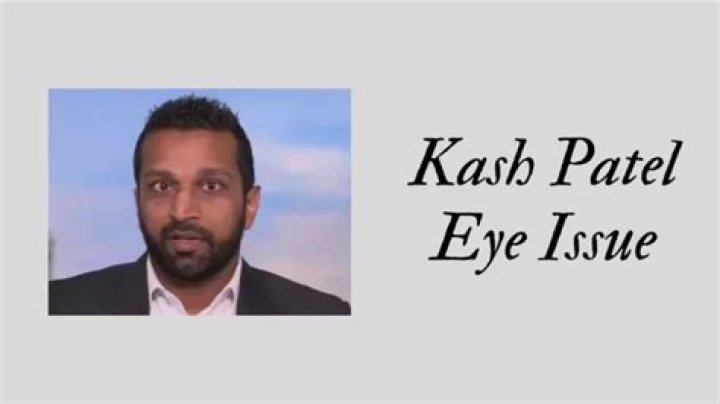 Kash Patels Eye Injury: Causes And Controversies